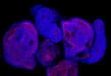 Mini Digestive Tract Found inside Cancerous Cells