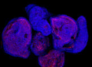 Mini Digestive Tract Found inside Cancerous Cells