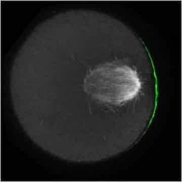 Chromosomes “Cheat” Their Way into the Egg Cell Gamete Formation