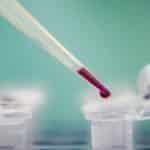 Philips Scores €6.3M Grant from EU for 4-year LIMA Project