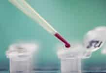 Philips Scores €6.3M Grant from EU for 4-year LIMA Project Philips Scores €6.3M Grant from EU for 4-year LIMA Project