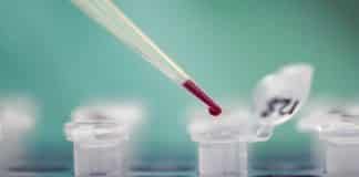 Philips Scores €6.3M Grant from EU for 4-year LIMA Project