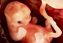 Umbilical Cord Blood May Help Improve Brain Connectivity and Motor Function