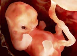 Umbilical Cord Blood May Help Improve Brain Connectivity and Motor Function