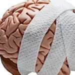 A Simple Spit Test for Better Predictability of Duration of Concussions