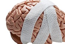 A Simple Spit Test for Better Diagnosis and Predictability of Duration of Concussions A Simple Spit Test for Better Predictability of Duration of Concussions