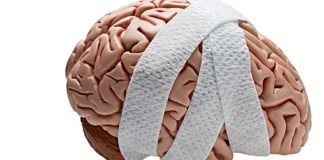 A Simple Spit Test for Better Predictability of Duration of Concussions