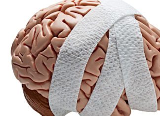 A Simple Spit Test for Better Diagnosis and Predictability of Duration of Concussions A Simple Spit Test for Better Predictability of Duration of Concussions