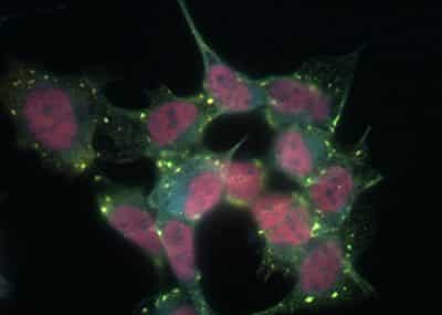Minimising Aggregation of Gritty Blobs of RNA ,Help Challenge Alzheimer
