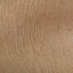 Scientists Give Boy Suffering From JEB Entirely New Skin - Gene Therapy