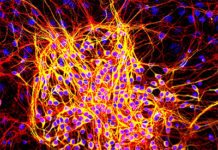 Protein Mutations Associated with Alzheimer’s Linked to Cancer Risk Protein Mutations Associated with Alzheimer’s Linked to Cancer Risk