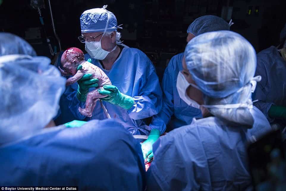 In a first, Woman Gives Birth Via Womb Transplant
