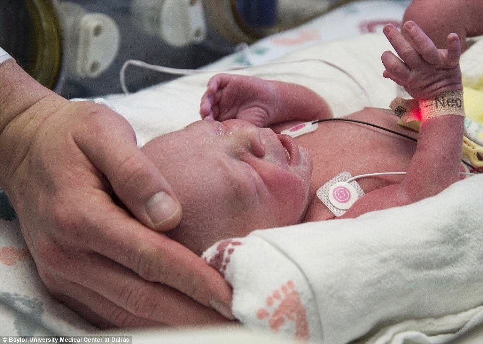 In a first, Woman Gives Birth Via Womb Transplant