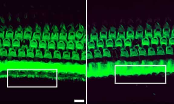 Breakthrough Alert: Researchers Edit Faulty Gene to Disrupt Hearing Loss