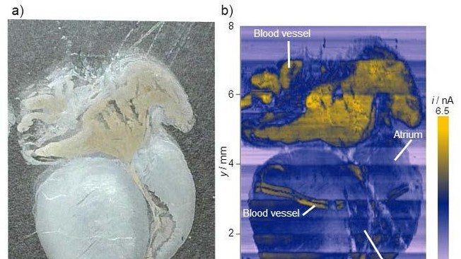 Scientists Use New Imaging Modality to Detect Cancer in Tissues
