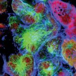 How Cancer-Attractive Are You? Find Out Through This 5-Minute Test