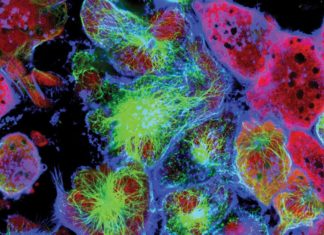 Study Throws Light on Mutations Facilitating Cancer Cell Survival How Cancer-Attractive Are You? Find Out Through This 5-Minute Test