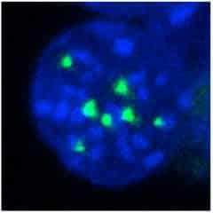 Multifunctional Protein found to be Critical for Blood Cell Development