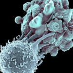 Inhibition of Cytosolic TXN reductase 1, A Novel Anti-Cancer Strategy Immunotherapy Hydrogel for Enhanced Cancer Therapy