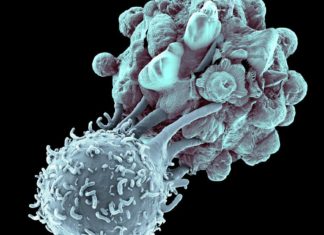 Immunotherapy Hydrogel for Enhanced Cancer Therapy