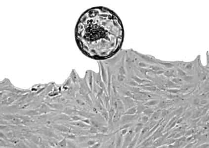 Uterine NKCs Play Key Role in Miscarriage Risk: Study