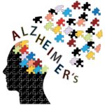 Gene Variant Protective against Alzheimer’s identified