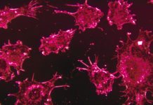 Promising Drug Found to Subdue Obesity-Associated Gene from Triggering Cancer IIAR Project Assistant Jobs