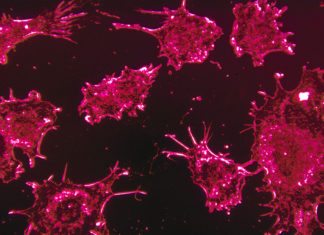 Promising Drug Found to Subdue Obesity-Associated Gene from Triggering Cancer IIAR Project Assistant Jobs