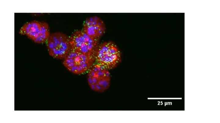 Endometrial Cancer Researchers Design Nanoparticles Loaded with Drugs
