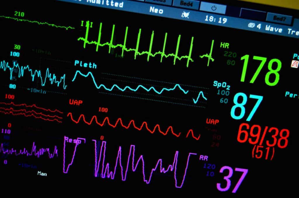Simple, Cost-Effective Radio Tags to Monitor Vital signs