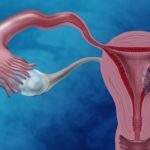 Endometrial Cancer Researchers Design Nanoparticles Loaded with Drugs