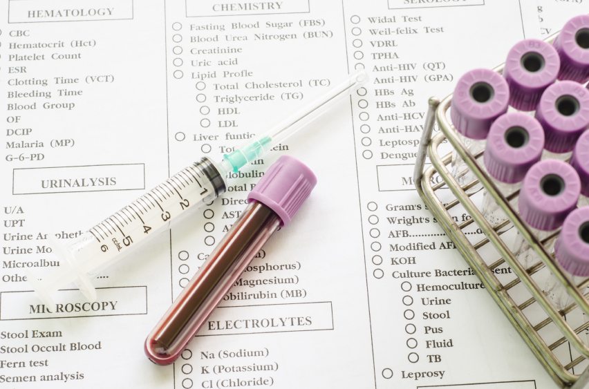 Vitamin Supplements Could be Messing with your Medical Tests, FDA Warns