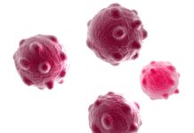 Plasmonic Biosensors for Naked-Eye Detection of Exosomes Plasmonic Biosensors for Naked-Eye Detection of Exosomes