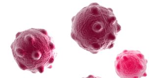 Plasmonic Biosensors  for Naked-Eye Detection of Exosomes