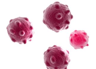 Plasmonic Biosensors  for Naked-Eye Detection of Exosomes Plasmonic Biosensors  for Naked-Eye Detection of Exosomes