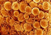3D Imaging of Fat Cells Unveils Potential Targets to Fight Obesity