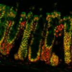 Computer-Aided Therapy for Gut Health