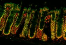 Computer-Aided Therapy for Gut Health Computer-Aided Therapy for Gut Health