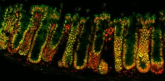 Computer-Aided Therapy for Gut Health