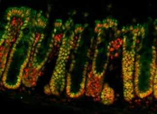 Computer-Aided Therapy for Gut Health Computer-Aided Therapy for Gut Health