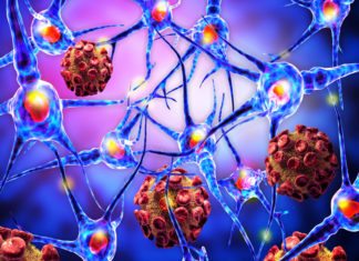 Study Finds Cytokine IL-23 to Play Crucial Role in Autoimmune Diseases