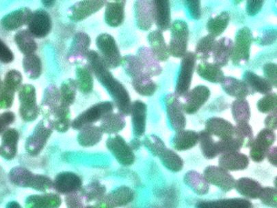 Bacteria Can Pick up Resistance from Rivals they Kill