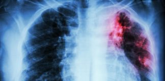 BCG to Rouse Innate Immune System through Bone Marrow Stem Cells
