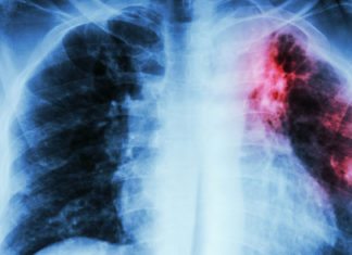 BCG to Rouse Innate Immune System through Bone Marrow Stem Cells