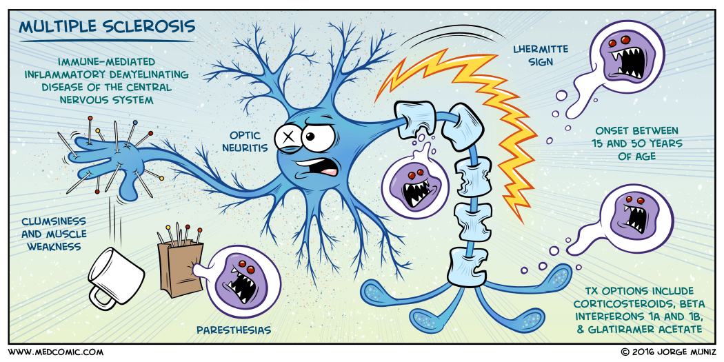Testosterone-induced Molecule Could Explain Why Men are Better Guarded against MS