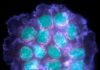 Protein That Keeps Metastatic Breast Cancer Cells Dormant Spanish scientists have described a mechanism involved in bone metastatic latency of oestrogen receptor-positive (ER+) breast cancer