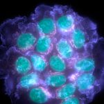 Spanish scientists have described a mechanism involved in bone metastatic latency of oestrogen receptor-positive (ER+) breast cancer