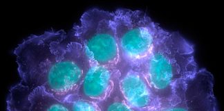 Spanish scientists have described a mechanism involved in bone metastatic latency of oestrogen receptor-positive (ER+) breast cancer
