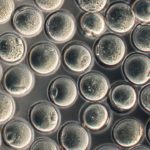 Role of Epigenetics in Preservation of Oocytes Through Childhood Role of Epigenetics in Preservation of Oocytes Through Childhood