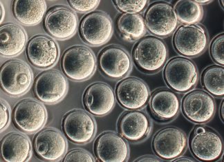 Role of Epigenetics in Preservation of Oocytes Through Childhood Role of Epigenetics in Preservation of Oocytes Through Childhood